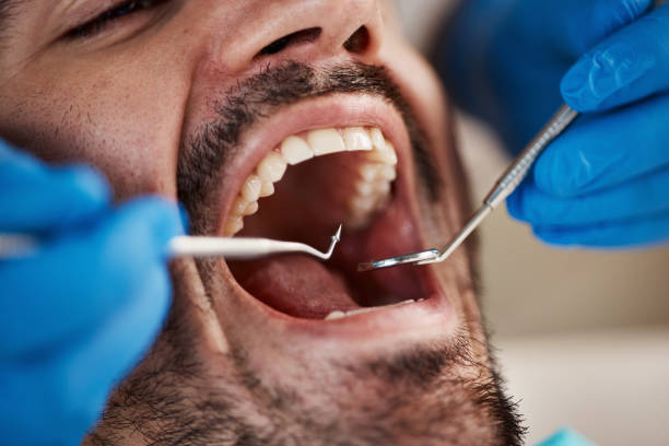 Best Emergency Treatment for Dental Infections or Abscesses in Fairfax, OK